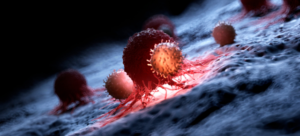 Иммунотерапия: новое перспективное направление в лечении рака