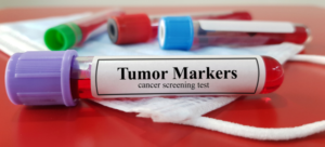 Progrese semnificative în lupta cu cancerul: terapiile imuno-oncologice