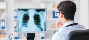 Prof. Dr. Mir Alireza Hoda: „Imunoterapia a revoluționat tratamentul cancerului pulmonar”