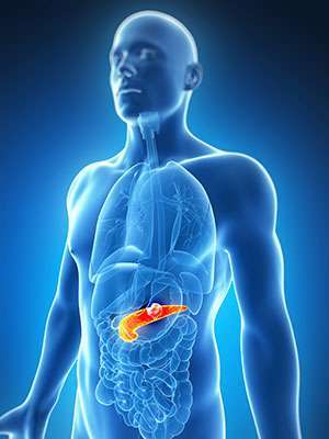 PANCREATIC CARCINOMA – CHALLENGES AND POSSIBILITIES