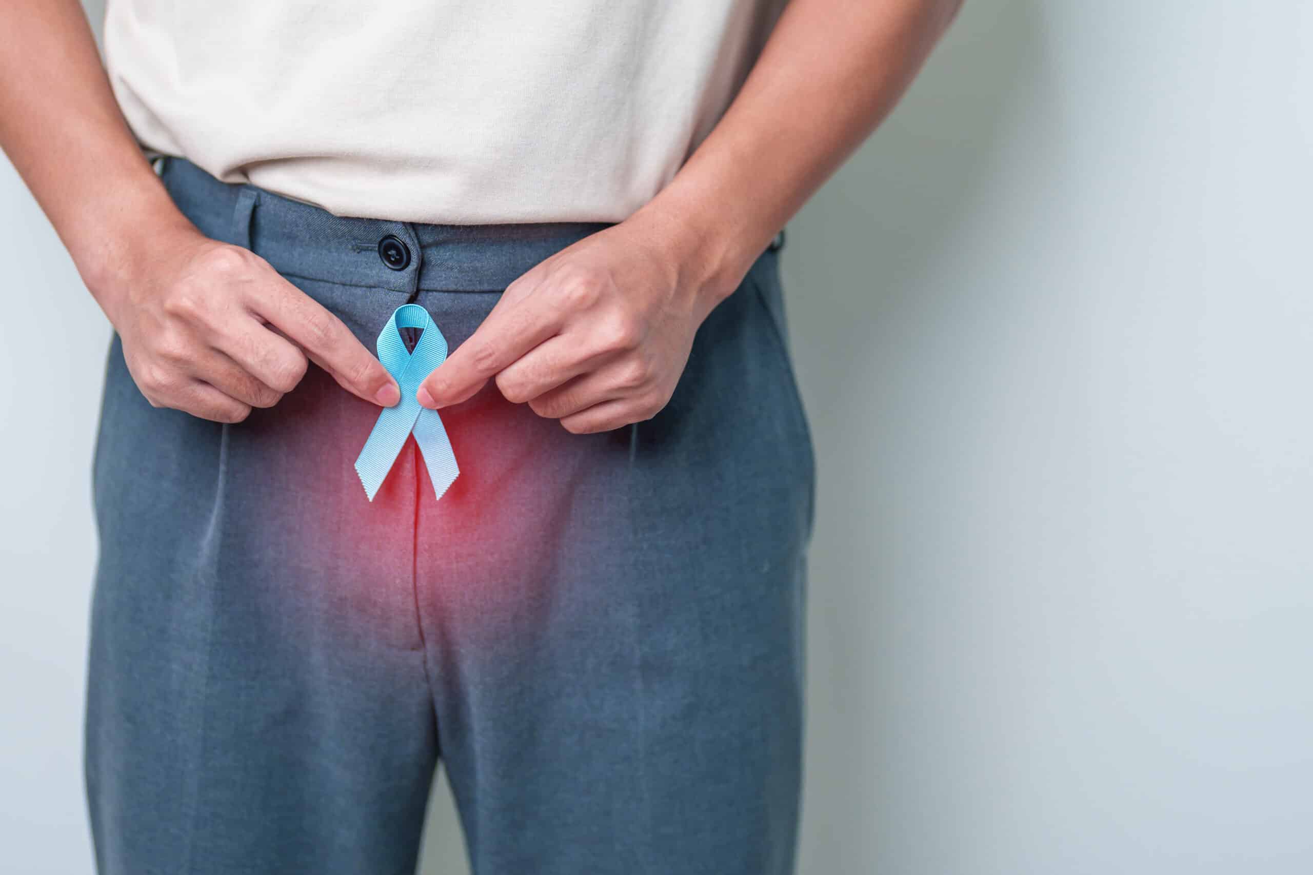 cancer de prostata