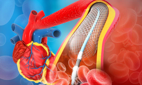 WPK Kardiologie / Angiologie