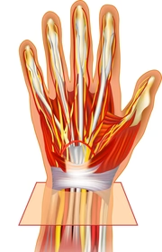 WPK Nervenchirurgie