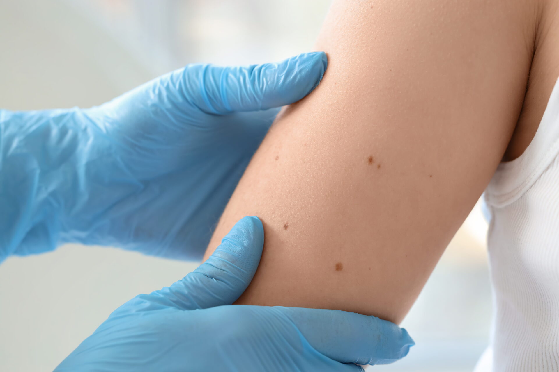 DERMATOLOGY – IN FOCUS: EXPERT TIPS ON WHITE SKIN CANCER