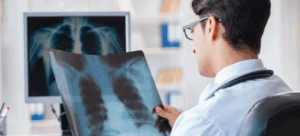 Când cancerul apare de mai multe ori în același plămân: un nou tipar care schimbă abordarea în tratamentul cancerului