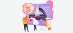 Cancerul pulmonar: 5 pași esențiali în diagnostic și tratament eficient