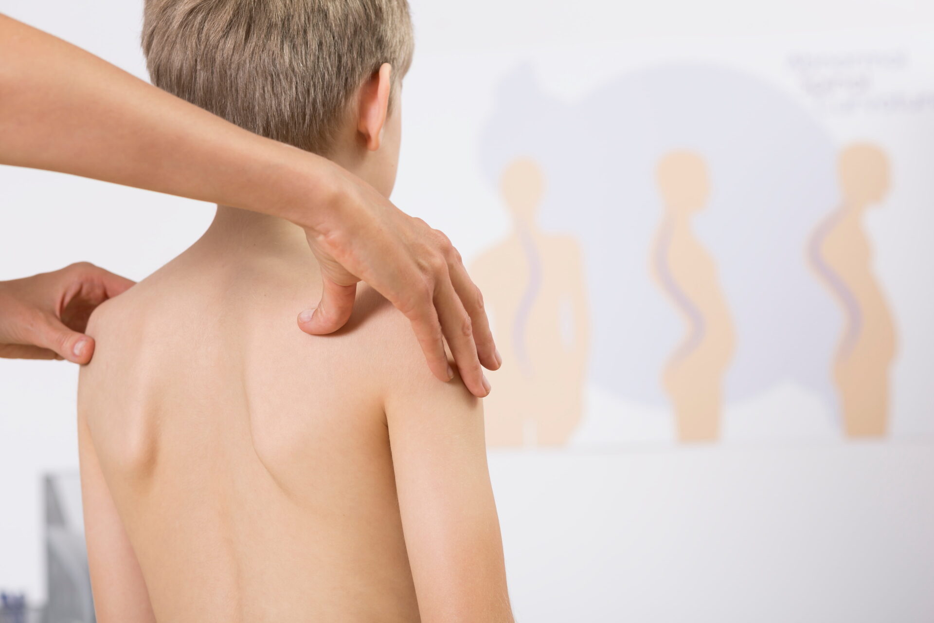 Modern Treatment for Pectus Excavatum (Funnel Chest)
