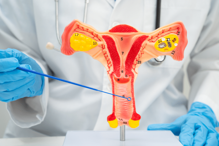 Cancere ginecologice