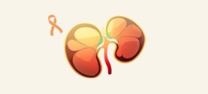 Simptomele cancerului renal: cum să identifici semnele timpurii ale afecțiunii