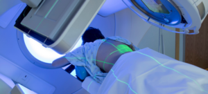 Radioterapia în bolile oncologice